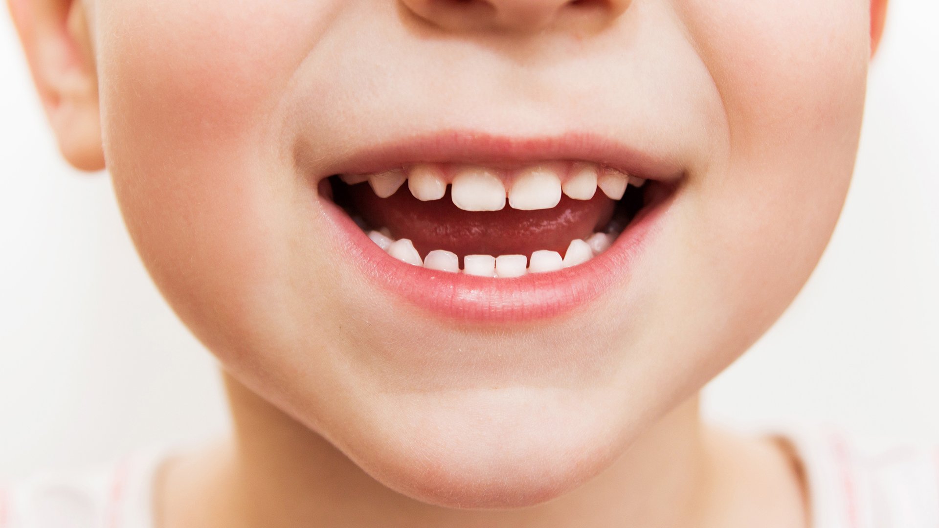 Deciduous Teeth May Help Identify Kids At Risk For Mental Disorders