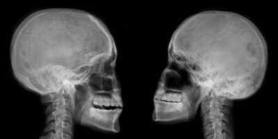 Craniofacial medicine : Understanding its role in dental medicine cover