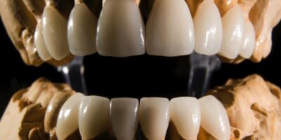 A Stronger And More Durable Enamel: Dentistry and Beyond.
