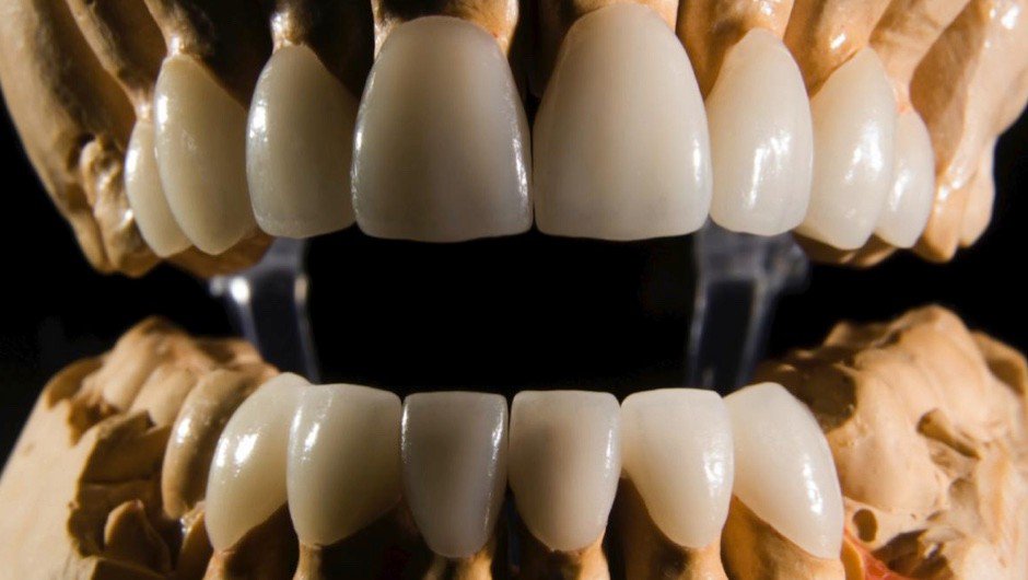 A Stronger And More Durable Enamel: Dentistry and Beyond.