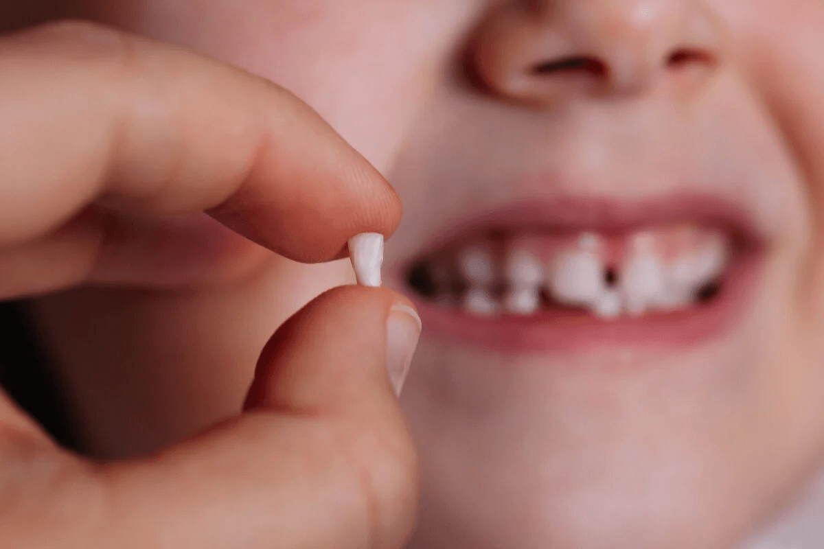Smaller Teeth Pose Bigger Problems! cover