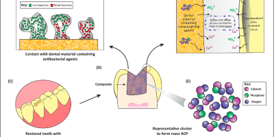 The New Antibacterial Composites To Effectively Control Carious Lesions: A Study cover