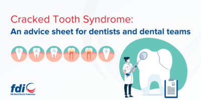 Cracked Tooth Syndrome Gets New Guidelines - FDI cover