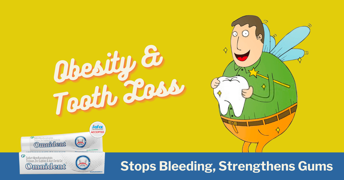 Obesity And Premature Tooth Loss - An Epidemiological Study cover
