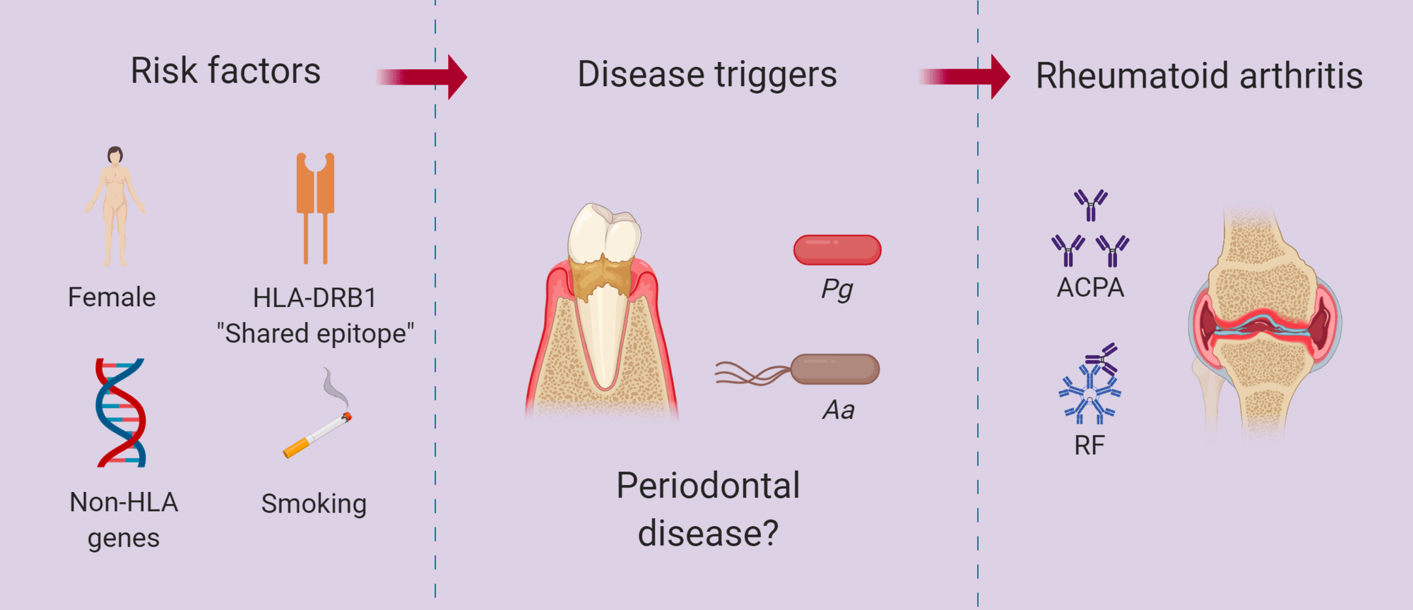 Periodontitis Unveils Deeper Relationship to Rheumatoid Arthritis cover