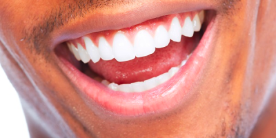 10 tips you can tell your patient for stronger and whiter teeth cover