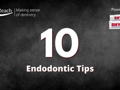 10 Endodontic Tips for a Fresher Dentist cover