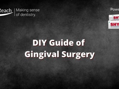 DIY Guide of Gingival Surgery for a Fresher Dentist cover