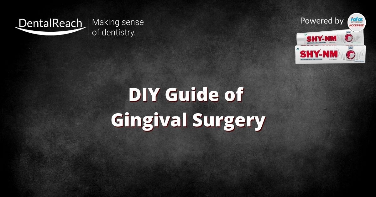 DIY Guide of Gingival Surgery for a Fresher Dentist cover
